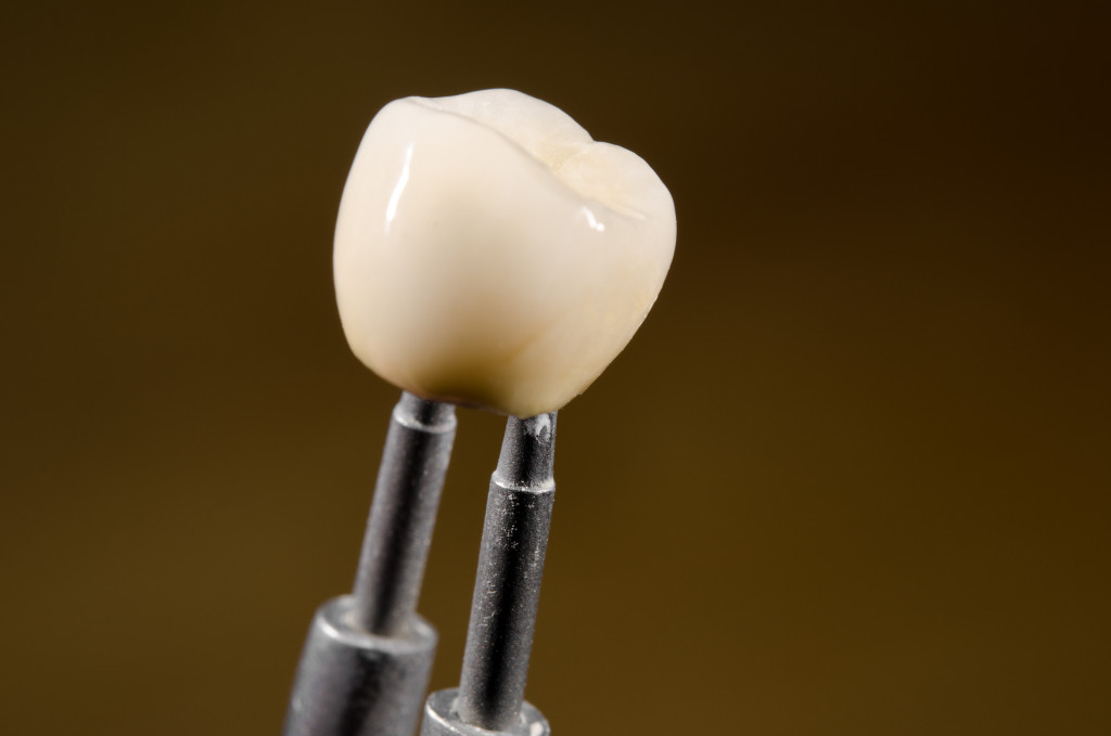 Dental implant procedure